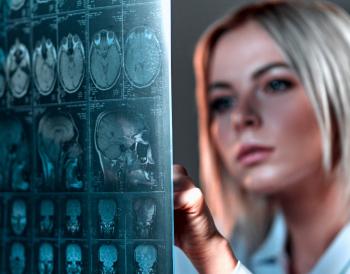 Epilepsi Nedir, Epileptoloji ve Epileptolog ne demektir?